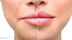 Top 5 Trending Cosmetic Surgeries You Should Know About in 2025