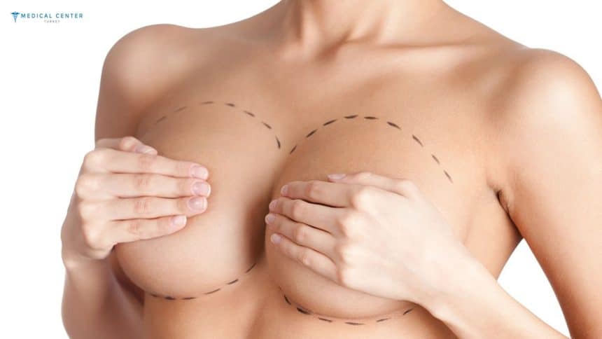 How Painful is Breast Reduction in Turkey 2025?
