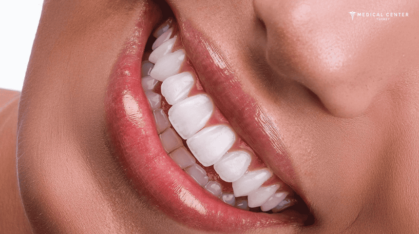 Can I Fix My Smile in Just One Trip to Turkey?