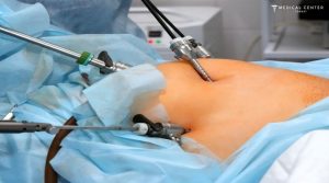 Are Bariatric Surgeries Popular Among Medical Tourists in 2025?