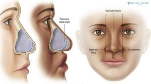 What Procedures Do Tourists Choose Most in Turkey?