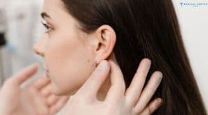 How Long is the Recovery for Ear Correction in Turkey?