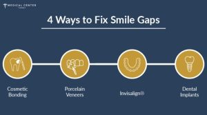 Can I Fix My Smile in Just One Trip to Turkey?