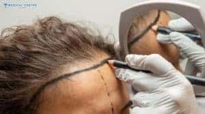 What Procedures Do Tourists Choose Most in Turkey?