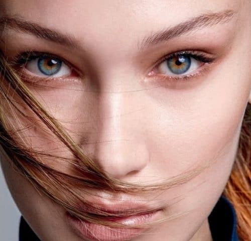 Bella Eyes Surgery in Turkey Bella Eyes Surgery in Turkey