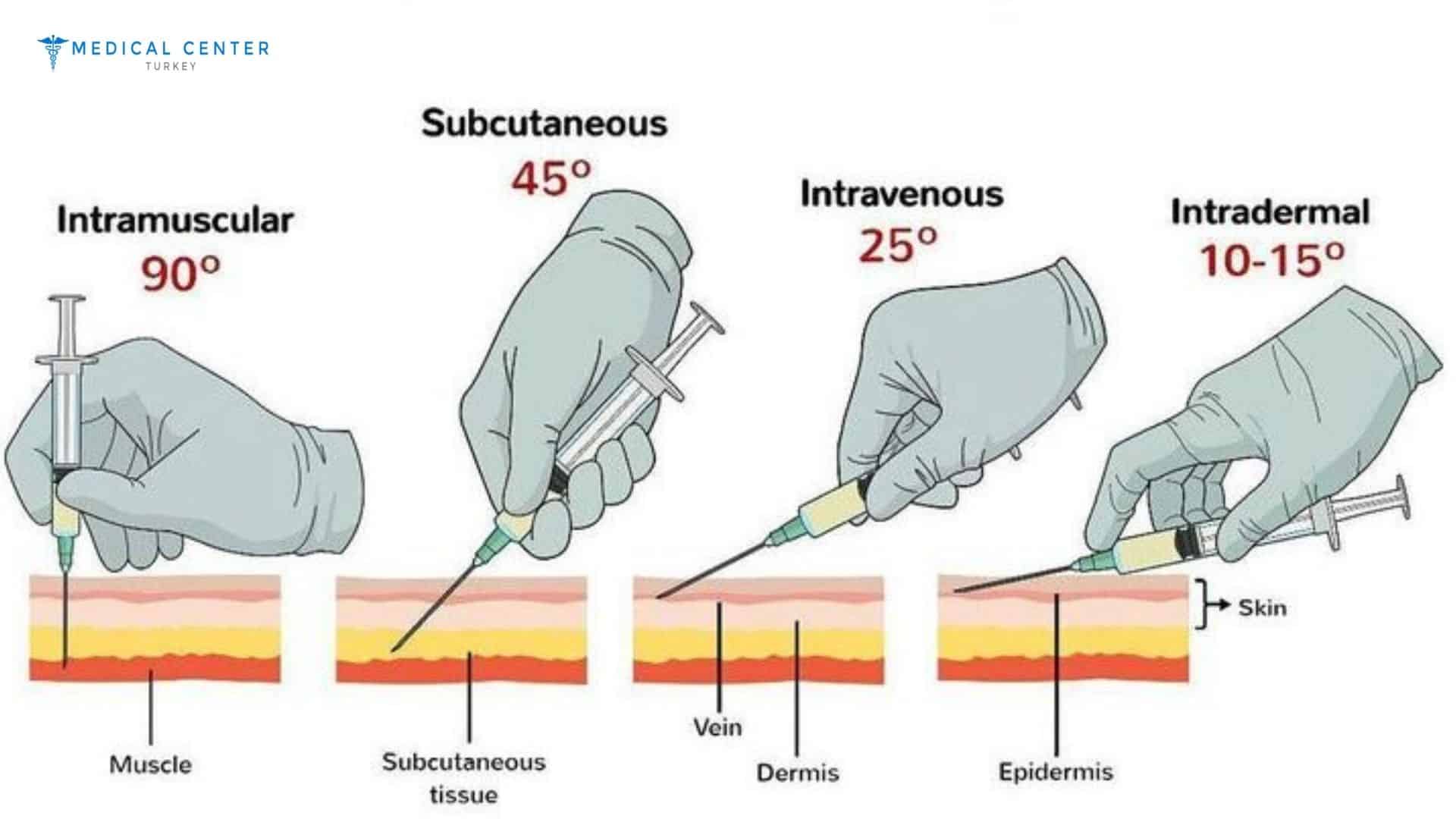 Best Botox Alternatives Right Now in Turkey