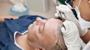 2026'da saç ekiminde neler yeni?