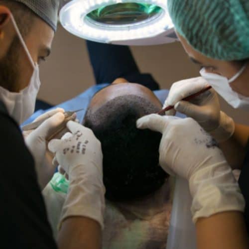 Which Hair Transplant Technique Works Best in 2026?