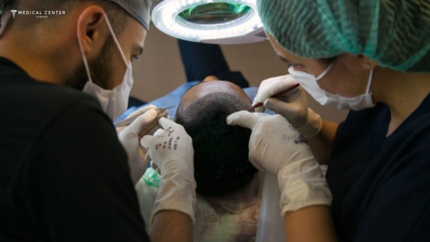 Which Hair Transplant Technique Works Best in 2026?