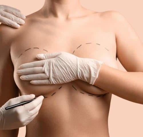All Options For Breast Augmentation All Options For Breast Augmentation
