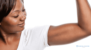 How Arm Lift Surgery Is Evolving in Turkey?