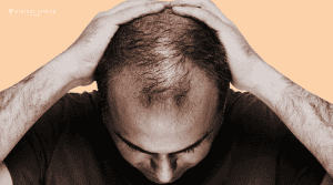What’s the Best Hair Loss Solution in 2026