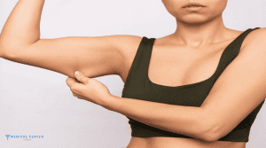 How Arm Lift Surgery Is Evolving in Turkey?