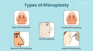 Why is 2026 the Best Year to Get a Nose Job?
