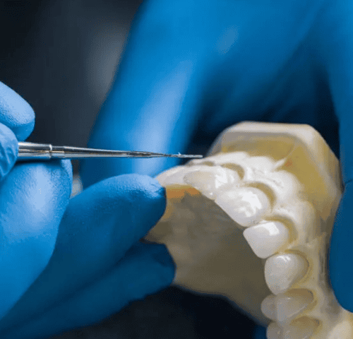 Transform Your Smile with Dent Restoration