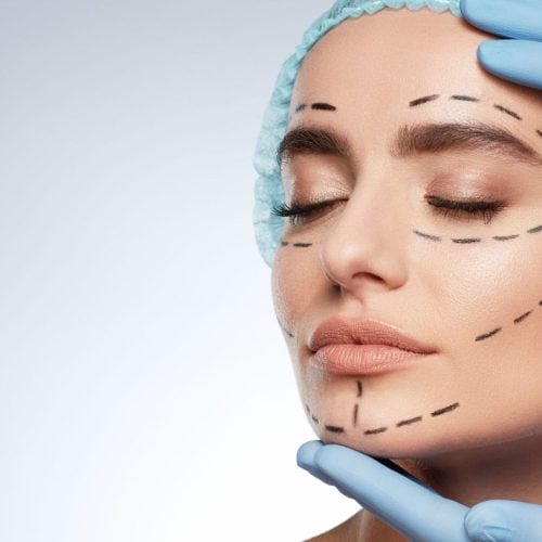 What Changes Can Be Expected After Facelift Surgery? What Changes Can Be Expected After Facelift Surgery?