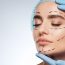 What Changes Can Be Expected After Facelift Surgery?