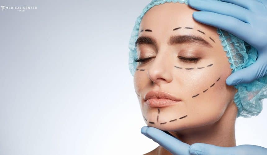 What Changes Can Be Expected After Facelift Surgery?