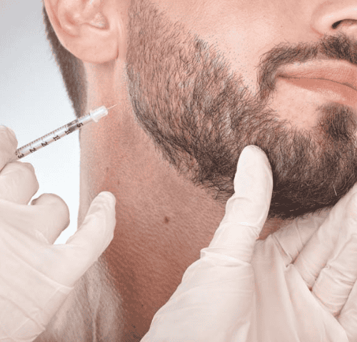 Beard Transplants Tips for Natural Looking Results