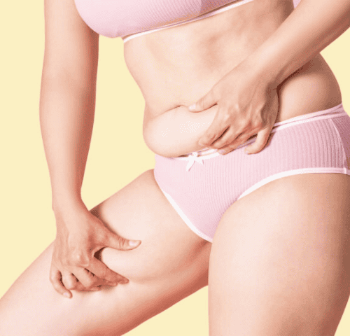 Maintaining Liposuction Result Tips and Lifestyle Advice Maintaining Liposuction Result Tips and Lifestyle Advice
