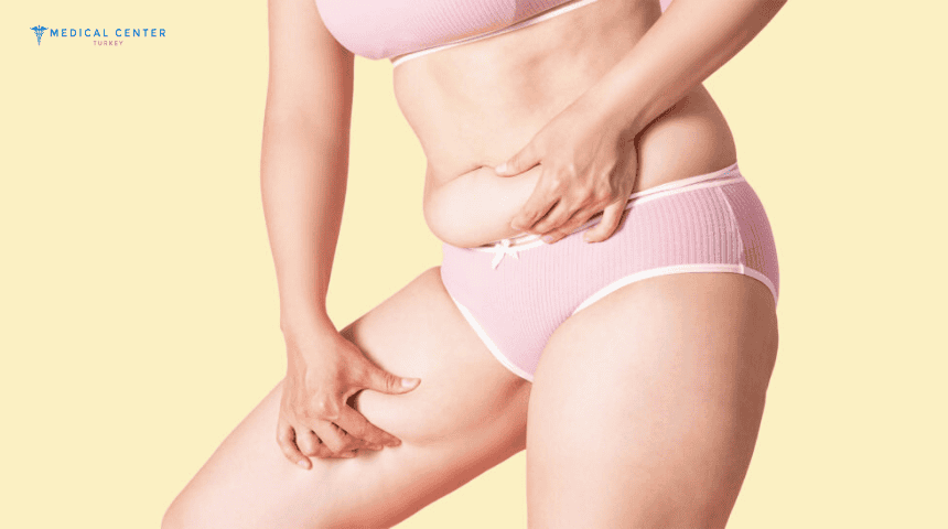 Maintaining Liposuction Result Tips and Lifestyle Advice