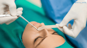 How to Prepare for Your Nose Surgery Procedure