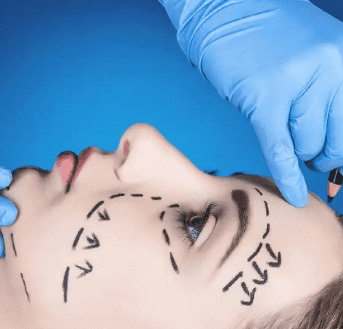 Everything You Need to Know About Plastic Surgery