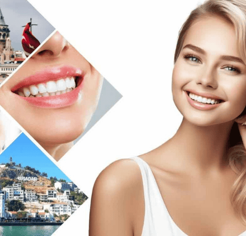 Cosmetic Dentistry in Turkey: From Smile Design to Dental Implants Cosmetic Dentistry in Turkey: From Smile Design to Dental Implants