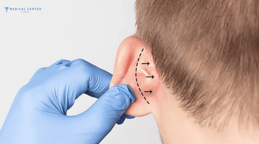 Ear Correction Surgery (Otoplasty) Who Is a Good Candidate? Ear Correction Surgery (Otoplasty) Who Is a Good Candidate?