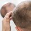 Hair Transplant Recovery Process and Care Tips