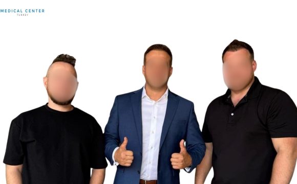 3 Brothers Hair Transplant Journey in İstanbul