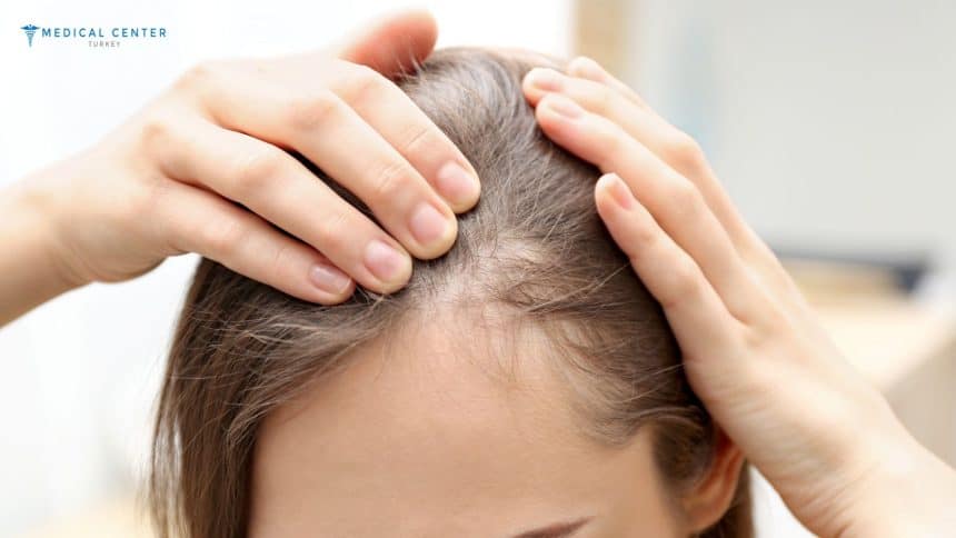 Emily’s Hair Transplant Journey
