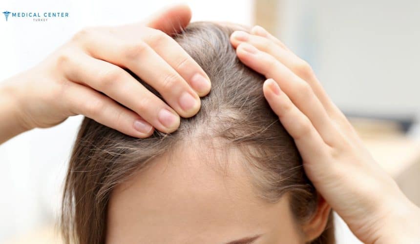 Emily’s Hair Transplant Journey