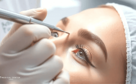 Everything You Should Know About Micro Brow Implant