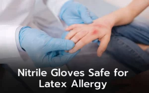Doctor's gloved hands examining a patient's hand with a latex allergy. Nitrile gloves offer a safe alternative.
