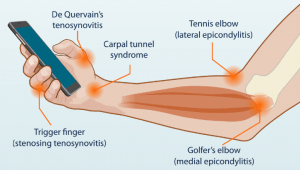 elbow issues from texting