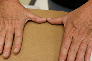 Donna Hands Post Surgery