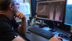 Double Bunionectomy Surgery Featured