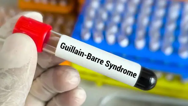 china GuillainBarre Syndrome Drugs Market Outlook 2025: Forecasting Growth in a Time of Economic and Policy Shifts