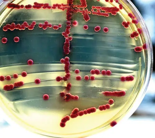 North America Protein Expression Systems Market In Focus: Size, Share, and Growth Trends Explored through 2037