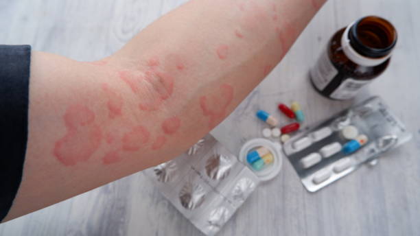 North America Systemic Antifungals Market Analysis: Trends, Opportunities, & Forecast