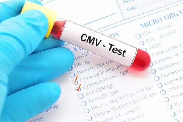 China Cytomegalovirus Disease Treatments Market In Focus: Size, Share, & Growth Trends Explored through 2035