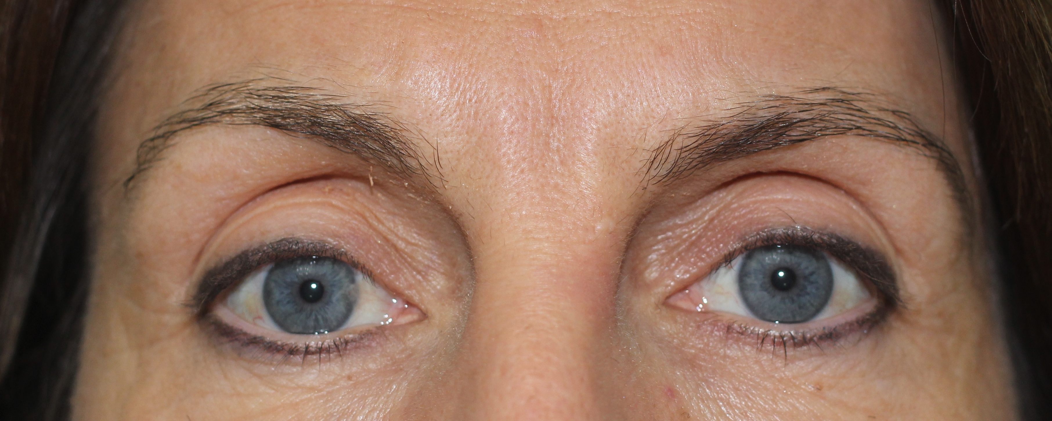 Brows Before