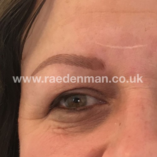 eyebrow medical tattoo after
