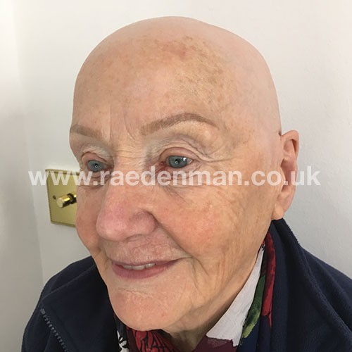 eyebrow medical tattoo after