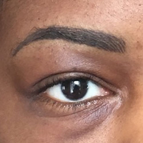 eyebrow medical tattoo after