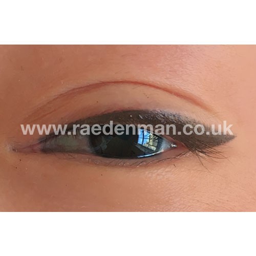 medical tattooing patchy lips before