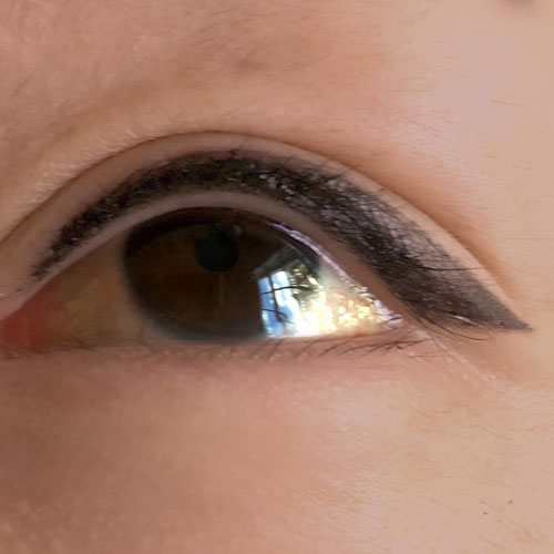 medical tattooing patchy lips before