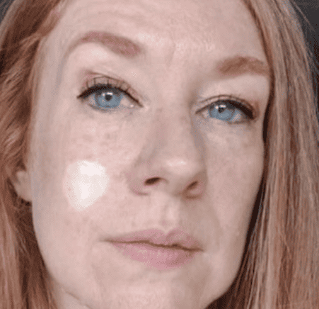 skin graft tattoo before