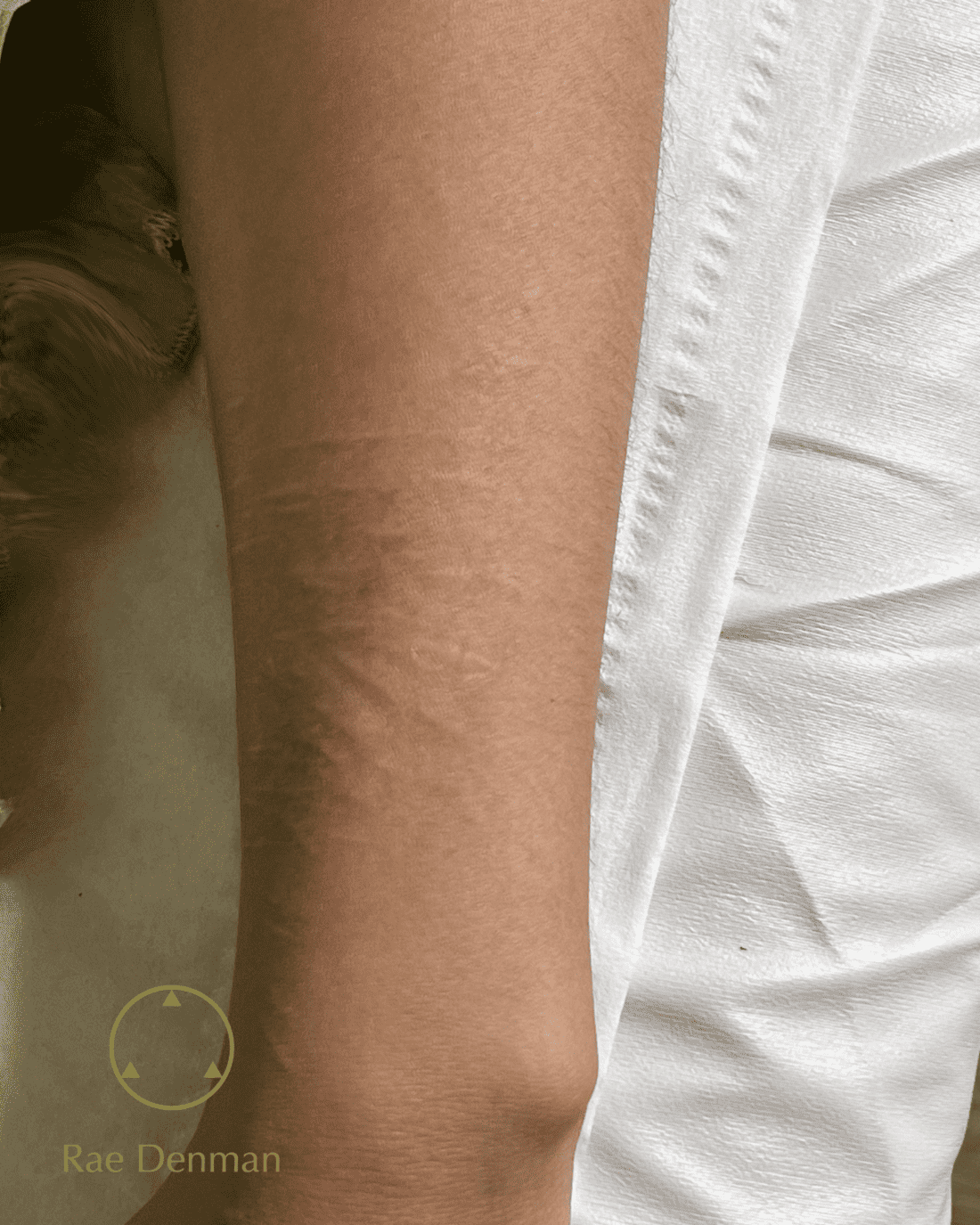 medical tattooing for scars after